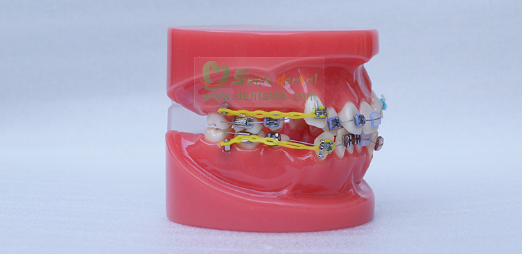 TM-B1-02 Orthodontic Model